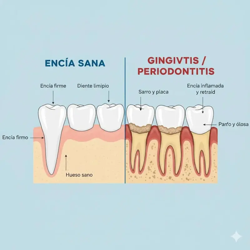 Ilustración veterinaria comparativa: dientes de perro con encía sana frente a encía con gingivitis, con etiquetas explicativas.